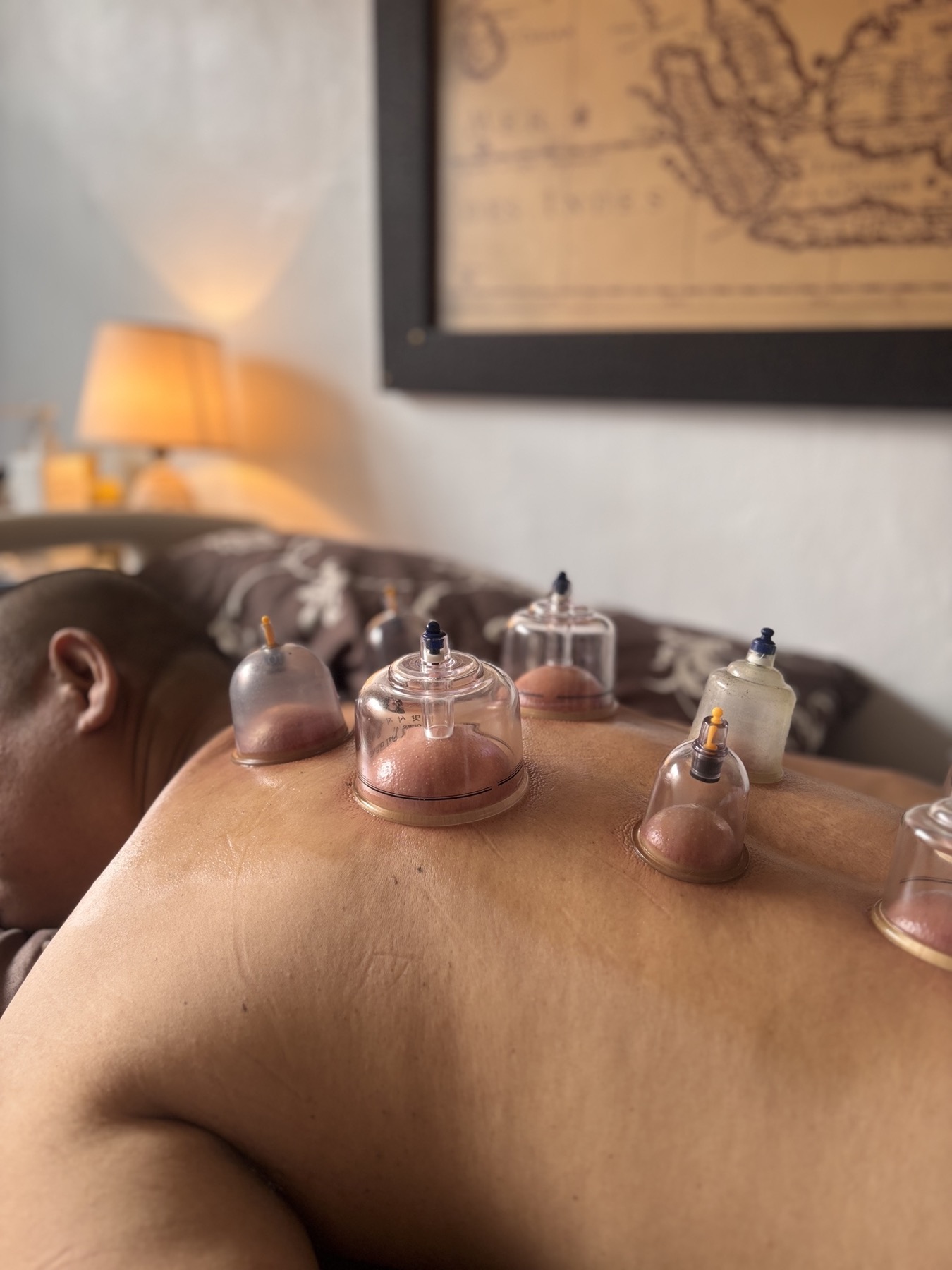 Acupuncture and complementary care support at MMCLI Care Center